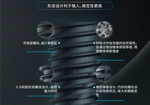 洁净、安全、高效：爱瑧IZEN（又名：爱臻）种植体以高标准技术树立韩系品牌新标杆